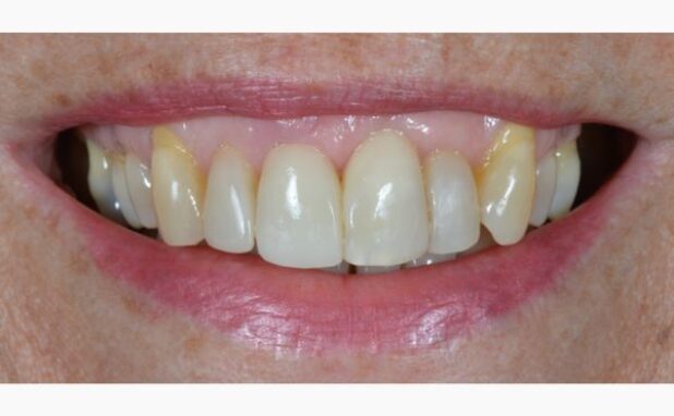 After -Peacock Dental Spa