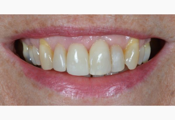 After -Peacock Dental Spa