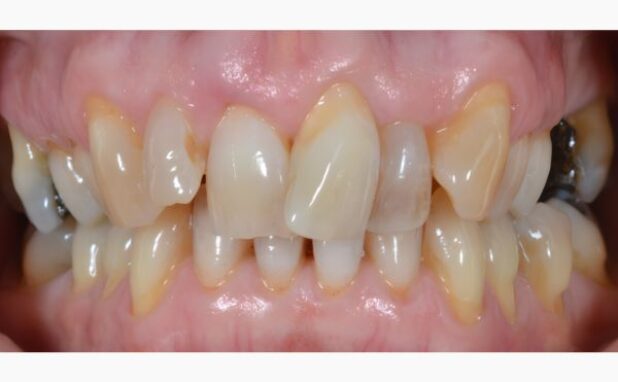 Before - Peacock Dental Spa