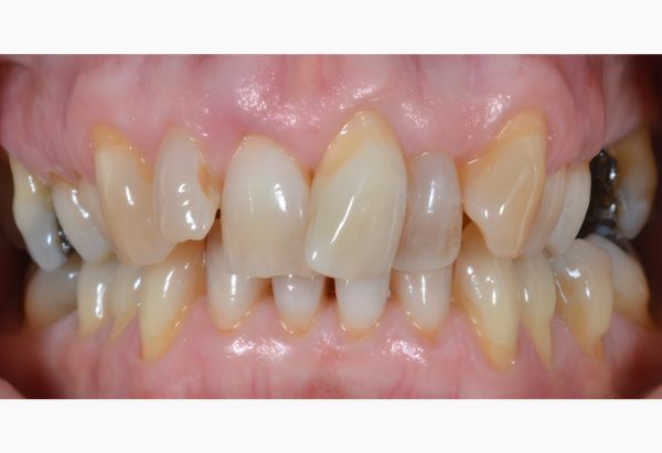 Before - Peacock Dental Spa