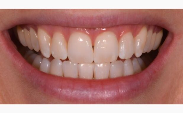 After -Peacock Dental Spa