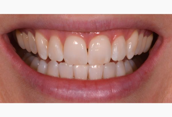 After -Peacock Dental Spa