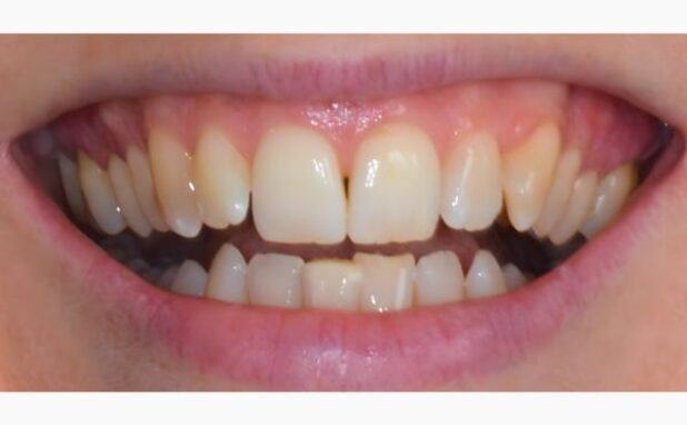 Before - Peacock Dental Spa