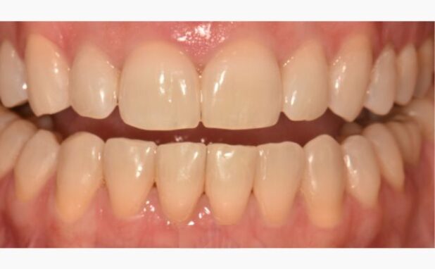 After -Peacock Dental Spa