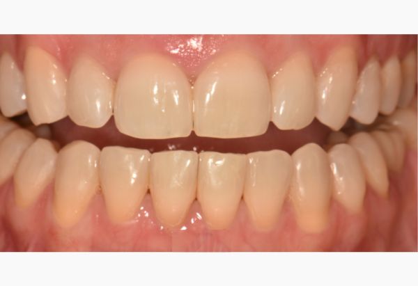 After -Peacock Dental Spa