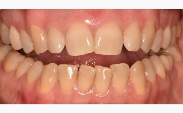 Before - Peacock Dental Spa