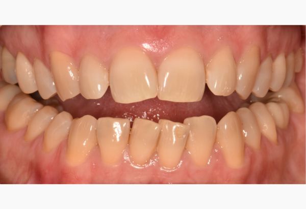 Before - Peacock Dental Spa