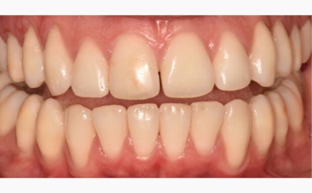 After -Peacock Dental Spa