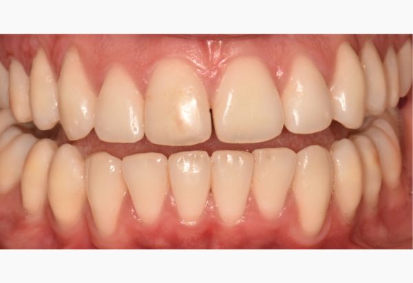 After -Peacock Dental Spa