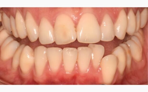 Before - Peacock Dental Spa