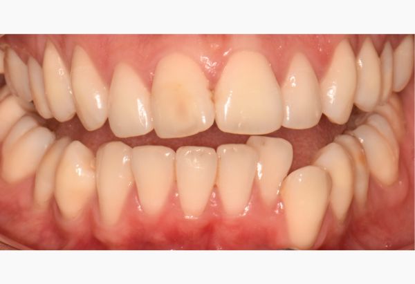 Before - Peacock Dental Spa