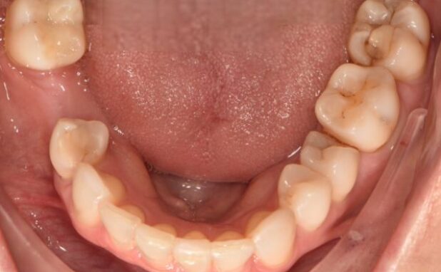 After -Peacock Dental Spa