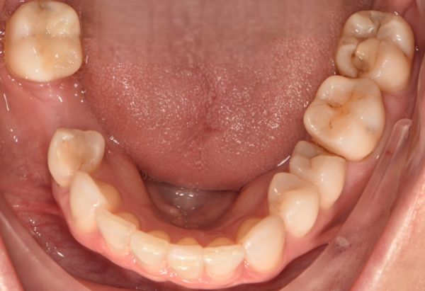 After -Peacock Dental Spa