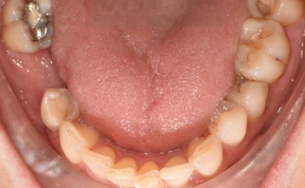 Before - Peacock Dental Spa