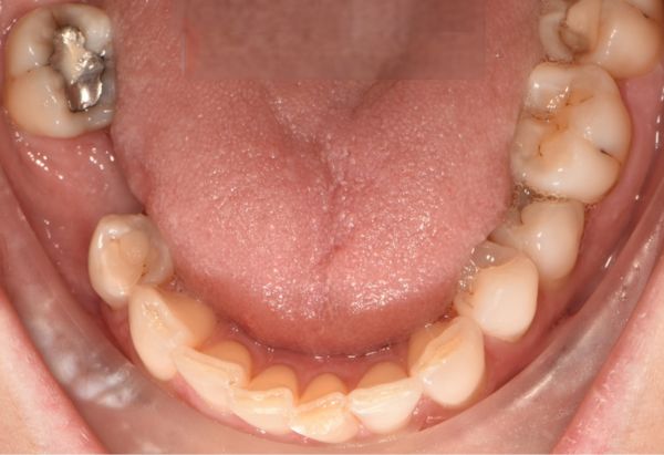 Before - Peacock Dental Spa