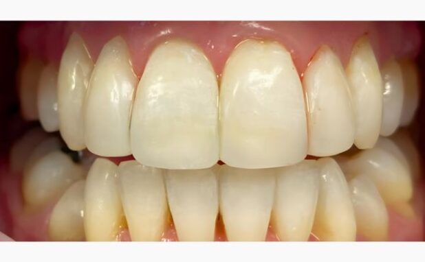 After -Peacock Dental Spa