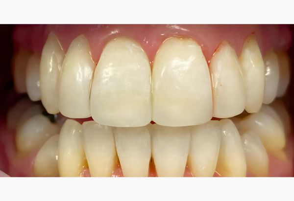 After -Peacock Dental Spa