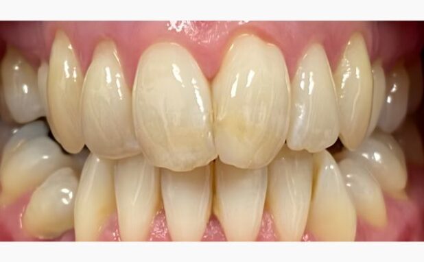 Before - Peacock Dental Spa