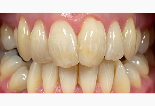 Before - Peacock Dental Spa