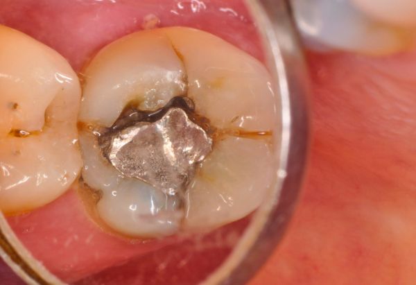 After -Peacock Dental Spa