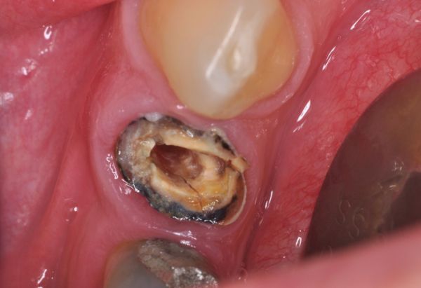 Before - Peacock Dental Spa