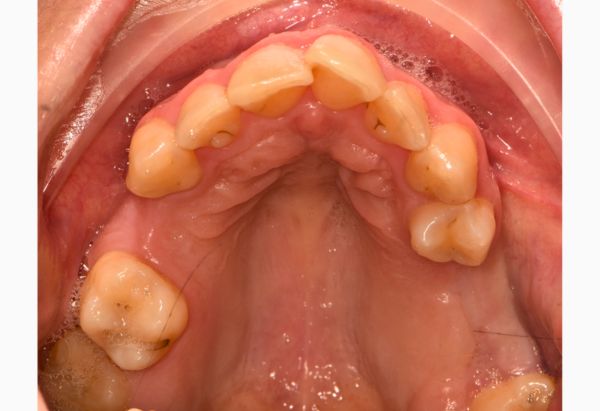 After -Peacock Dental Spa