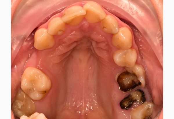 Before - Peacock Dental Spa