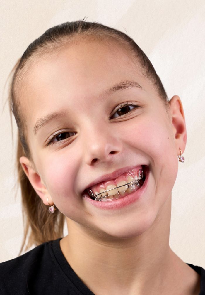 Treatment -  Peacock Dental Practice